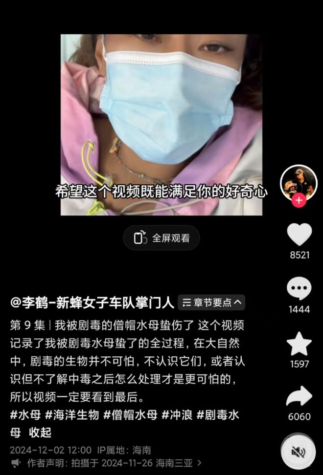 被僧帽水母蜇伤两个提醒请一定注意AG真人冲浪爱好者称在海南三亚(图1)